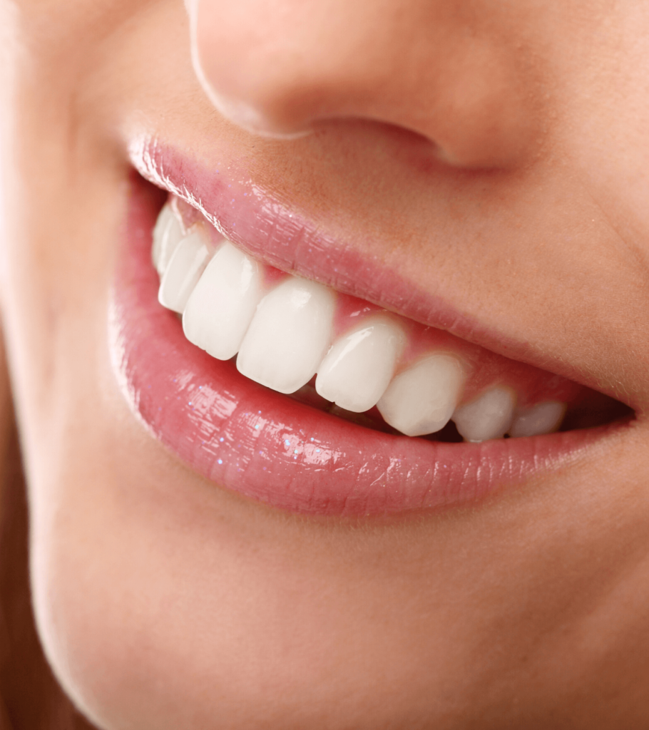 Come avere denti bianchissimi
